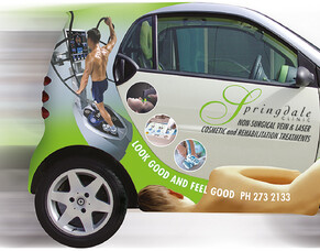 Fringe benefit tax and work-related vehicles